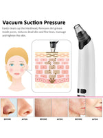 Electric Blackhead Remover